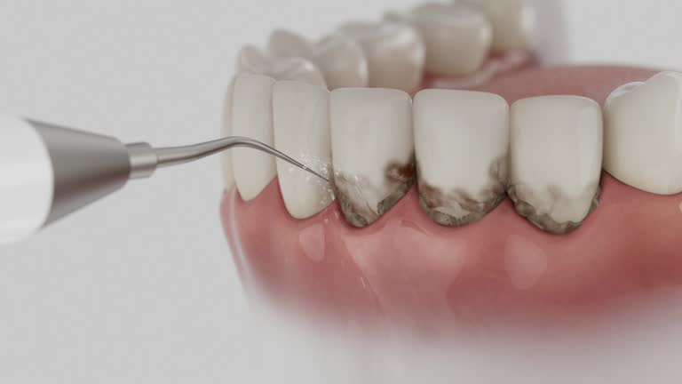 Trusted Teeth Cleaning And Checkup service in Reed City, MI - Dentist Open Now